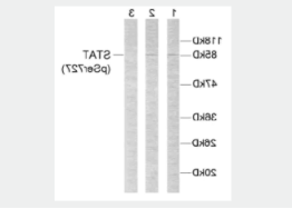 Anti-STAT3 (phospho S727)抗体.png
