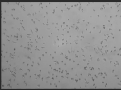 Neutrophil小鼠骨髓或外周血中性粒细胞膜复合纳米脂质体