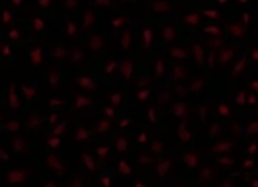 荧光修饰响应型造影脂质体定制技术(Fluorescently Labeled Stimuli-Responsive Imaging Liposome Customization Technology)